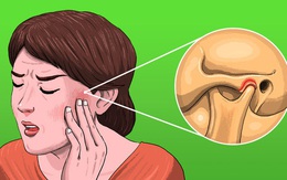 5 cơn đau "khó hiểu" khiến bạn dễ nhầm lẫn với đau răng nhưng có thể đó là dấu hiệu của những căn bệnh khó chữa