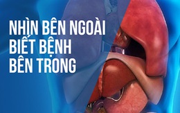 BS hướng dẫn cách "nhìn ngoài thấy trong" để xem bạn đang khỏe hay có bệnh: Rất hữu ích