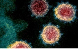 WHO cảnh báo virus SARS CoV-2 có thể không bao giờ biến mất