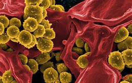 Cảnh báo loại vi khuẩn nguy hiểm kháng nhiều loại kháng sinh: Nếu nhiễm rất khó điều trị, tiên lượng tử vong cao