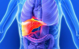 Chất độc phá hủy tế bào gan mỗi ngày: 5 việc nhỏ cần làm để ngăn chặn nguy cơ hỏng gan
