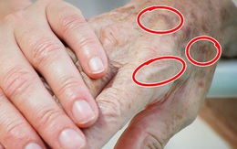 7 vùng trên cơ thể giúp bạn nhận biết dấu hiệu tuổi tác đã bắt đầu lộ rõ