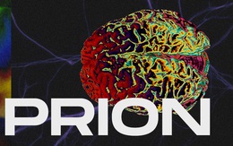 Những cái chết thầm lặng vì nhiễm prion: Phân tử "thây ma" âm thầm biến não bộ thành bọt biển