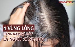 Lông 4 vùng này trên cơ thể càng dày, càng rậm thì càng sống thọ, đặc biệt là cái đầu tiên, nhưng nhiều người không biết lại tự ti vì nó