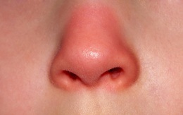 Mũi là "đèn tín hiệu" của phổi: Nếu mũi xuất hiện 3 dấu hiệu lạ thì bạn nên đi kiểm tra phổi ngay