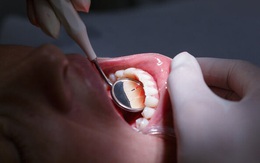 Sức khỏe bắt đầu từ hàm răng: BS nói bạn chắc chắn đang có vấn đề về răng vì chưa làm tốt 3 việc