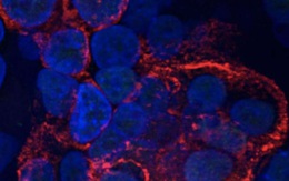 SARS-CoV-2 gây hại cho các tế bào phổi chỉ trong vài giờ như thế nào?