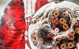 Chuyên gia WHO: Tốc độ lây lan của virus SARS-CoV-2 trên toàn thế giới đang chậm lại