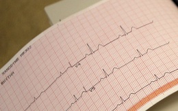 25% bệnh nhân mắc COVID-19 thể nặng bị bệnh tim mạch