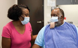 9 bệnh nhân Covid-19 ở Mỹ bị biến chứng lưỡi phình to dị thường, các bác sĩ đang cố gắng tìm ra lý do tại sao