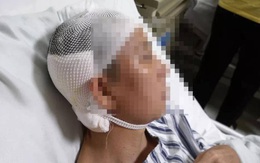 Người phụ nữ bị "khoan thủng" màng nhĩ, suýt chết vì viêm tai giữa, nguyên nhân xuất phát từ hành động chủ quan khi gội đầu