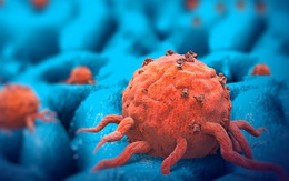 Bất cứ ai cũng có tế bào ung thư trong cơ thể: 4 "nguyên tắc vàng" có thể chặn đứng sự hình thành của tế bào "tử thần" hiệu quả