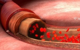 Người có mạch máu khỏe mạnh thường không làm 5 việc này, nếu bạn cũng giống họ thì có thể phòng được nhiều bệnh