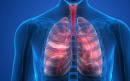 Học sinh 12 tuổi đã mắc ung thư phổi giai đoạn cuối, cha mẹ sốc nặng khi bác sĩ chỉ ra nguyên nhân: Thói quen xấu rất nhiều người mắc phải đang bào mòn sức khỏe mỗi ngày