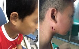 Hai bệnh nhân ở Thanh Hoá nhiễm khuẩn Whitmore, một thiếu niên tử vong
