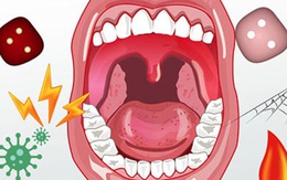 Gần một nửa dân số thế giới mắc bệnh về răng miệng