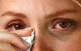 Mắt đỏ au sau khi mắc Covid-19: Bằng chứng cho thấy virus SARS-CoV-2 tác động tới mắt