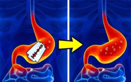 Dạ dày của con người có thể làm tan lưỡi dao cạo và những sự thật bất ngờ
