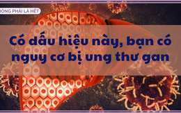 Da chuyển vàng và 3 biểu hiện sau là dấu hiệu sớm của ung thư gan: Có chỉ dù 1 cũng nên kiểm tra ngay để không bị tử thần "đoạt mạng"