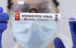 Bệnh đậu mùa khỉ và những hiểm họa khôn lường: Làm thế nào để tránh và những việc cần làm nếu mắc phải bệnh này?