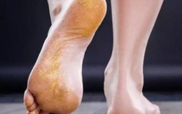 Dưỡng gan chính là tăng tuổi thọ, bàn chân xuất hiện 3 dấu hiệu là tín hiệu gan "cầu cứu"