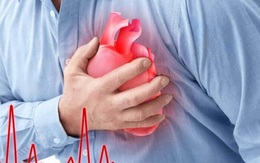 Thời điểm thường xảy ra cơn nhồi máu cơ tim trong tuần - Ai cũng nên biết để phòng tránh!