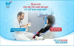 5 lợi ích của việc cấy ghép Implant có thể bạn chưa biết