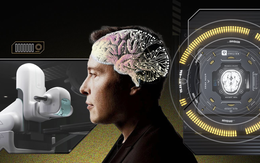 Giấc mơ cấy chip vào não người điên rồ của Elon Musk: Tự chế tạo robot phẫu thuật, sẽ thực hiện hơn 22.000 cuộc giải phẫu vào năm 2030, chi phí mỗi ca 10.000 USD