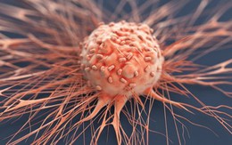 Có thể có 'tế bào tiền ung thư' nhưng không phải ai cũng mắc bệnh: Làm tốt 5 việc, ung thư sẽ phải 'sợ' bạn