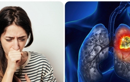 Triệu chứng ung thư phổi giai đoạn đầu
