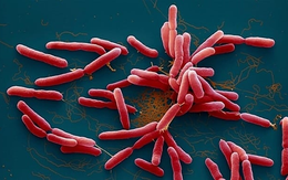 Phát hiện ca đầu tiên nhiễm vi khuẩn 'ăn thịt người' Whitmore ở Đắk Nông
