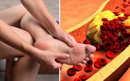 Dấu hiệu ‘kỳ lạ’ ở ngón chân cảnh báo mỡ máu đang tăng cao