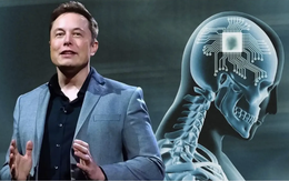 Công ty của Elon Musk được phép thử nghiệm cấy chip vào não người