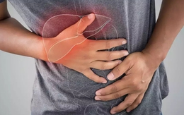 8 dấu hiệu cho thấy độc tố tích tụ quá nhiều trong gan