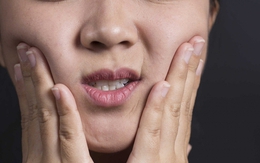 Vết loét trong miệng tưởng chừng bệnh thông thường nhưng lại có thể là dấu hiệu ung thư