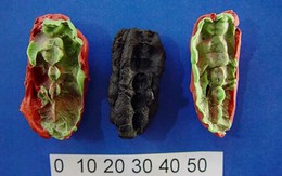 'Kẹo cao su' 10.000 năm tuổi tiết lộ sức khoẻ răng miệng của cư dân thời đồ đá
