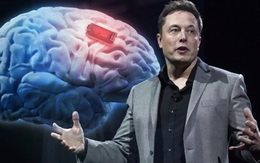 Gã ngông cuồng Elon Musk vừa làm được điều điên rồ: Lần đầu tiên cấy ghép thành công chip vào não người