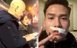 Hotboy đội tuyển Việt Nam phải khâu 24 mũi vì chấn thương, bố mẹ nghe tin khóc nghẹn vì thương con