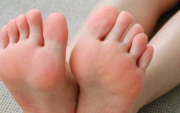 Người tuổi thọ ngắn thường có 3 dấu hiệu nhỏ này trên bàn chân: Hãy kiểm tra cơ thể mình ngay!