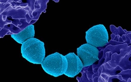 Nhật Bản cảnh báo về bệnh do vi khuẩn hiếm gặp lây lan nhanh kỉ lục