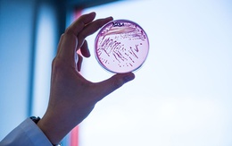 Giới khoa học phát hiện vi khuẩn 'ma cà rồng' khát máu người
