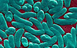 Người đàn ông nguy kịch do 'vi khuẩn ăn thịt người': Bác sĩ chỉ ra hành động làm tăng nguy cơ