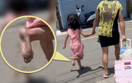"Mẹ ơi, nóng quá, chân con đau quá": Xót xa tiếng khóc của bé gái 6 tuổi bị mẹ bắt phải đi chân trần trên đường bê tông nóng như thiêu đốt vì làm mất giày