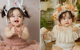 Từng mắc hội chứng lạ khi mới sinh, bé gái 1 tuổi ngày càng nổi tiếng trên MXH nhờ khuôn mặt đáng yêu như thiên thần