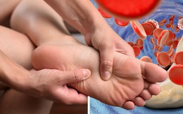 5 loại thực phẩm có thể đào thải axit uric nhanh chóng, bảo vệ thận: Toàn loại dễ kiếm