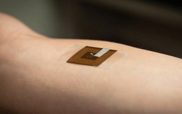 Độc đáo miếng dán phát hiện ung thư da