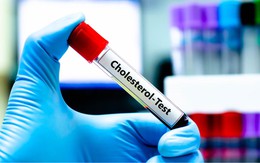 Mỡ máu cao vút bất ngờ hạ về mức bình thường: Bác sĩ thốt lên "5 thói quen này rất đáng học hỏi”