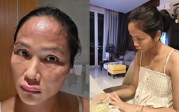 Chuyện gì xảy ra với H'Hen Niê sau khi xuất hiện với gương mặt khác lạ