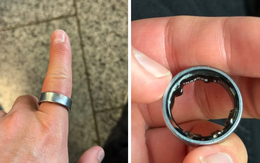 Người dùng hốt hoảng khi một sản phẩm của Samsung phồng pin, kẹt luôn trên ngón tay: "Vừa đau vừa sợ nổ"