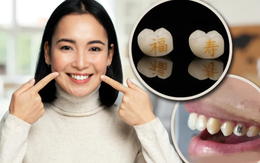 Sốc với mốt "xăm răng" ở Trung Quốc: Giới trẻ khắc chữ "làm giàu", "thành công" ngay trên răng